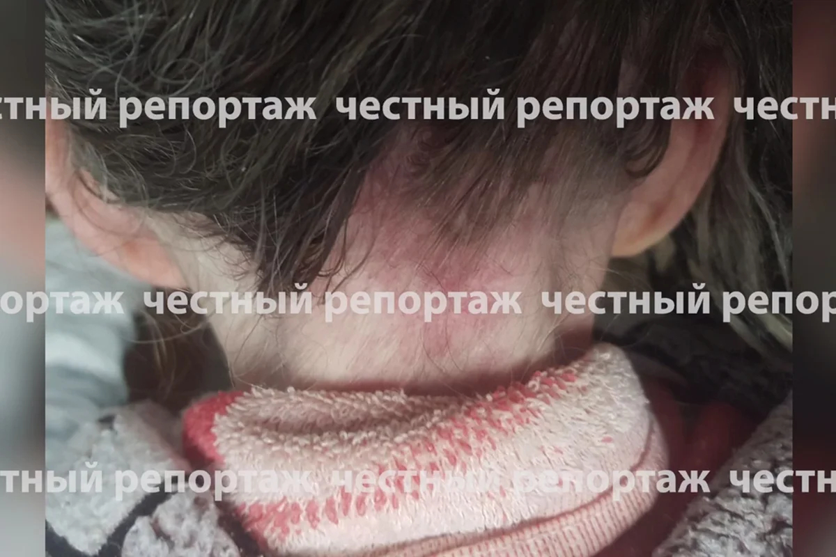 Постоялец уфимского пансионата. Фото: Telegram / Честный репортаж